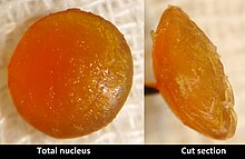 Front and side views of a highly opacified extracted cataract. It is uniformly yellow in colour.