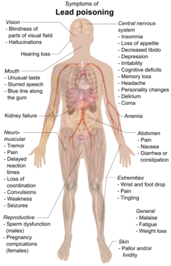 A chart of a human body with arrows pointing pieces of text to different parts of the body
