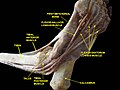 First metatarsal bone. Deep dissection.