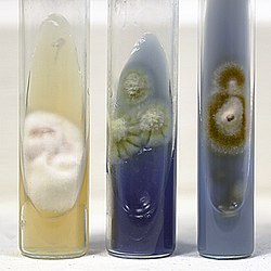 Three tubes of growth medium, the left showing a cottony white colony, the middle with three greenish flat colones and the right with one flat red colony