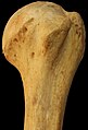 Humerus - superior epiphysis. Anterior view.