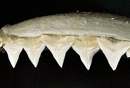 Upper teeth