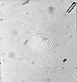 Image 15Myxozoans such as Myxobolus cerebralis are single-celled parasites, never more than 20 μm across. (from Animal)