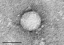 Electron micrograph