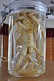 Cultivated American ginseng (P. quinquefolius)