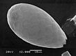 Euglypha, a prominent genus of testate amoebae