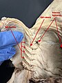 Image 10A ventral dissection of a pregnant female dogshark exposing its internal gill slits and internal spiracles. (from Shark anatomy)