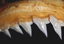 Upper teeth