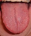 Human tongue