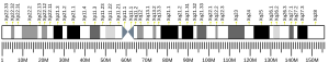 X chromosome (human)