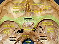 Orbital part of frontal bone