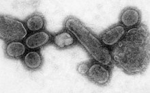 An electron micrograph of the virus that caused Spanish influenza