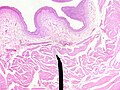 Layers of the bladder wall and cross-section of the detrusor muscle